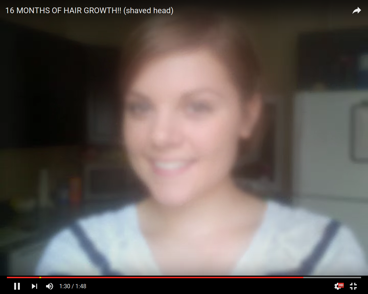 Tombent et cassent les cheveux chez lenfant
