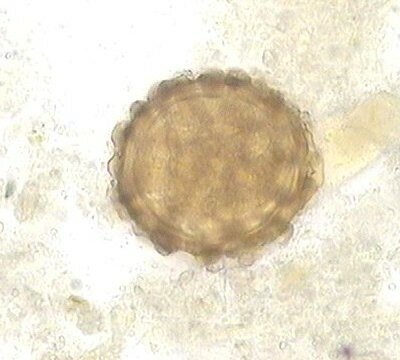 Les parasites chez les gens les enfants