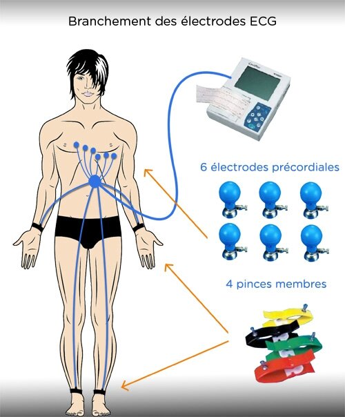 Экг датчики расположение на конечностях Privilegio trabajo duro traicionar comment placer les electrodes ecg delicado Ag